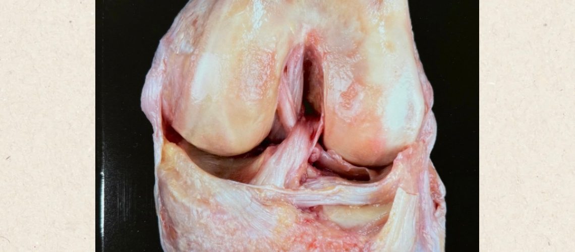 POST-RRSS-ESPEJO-1-2